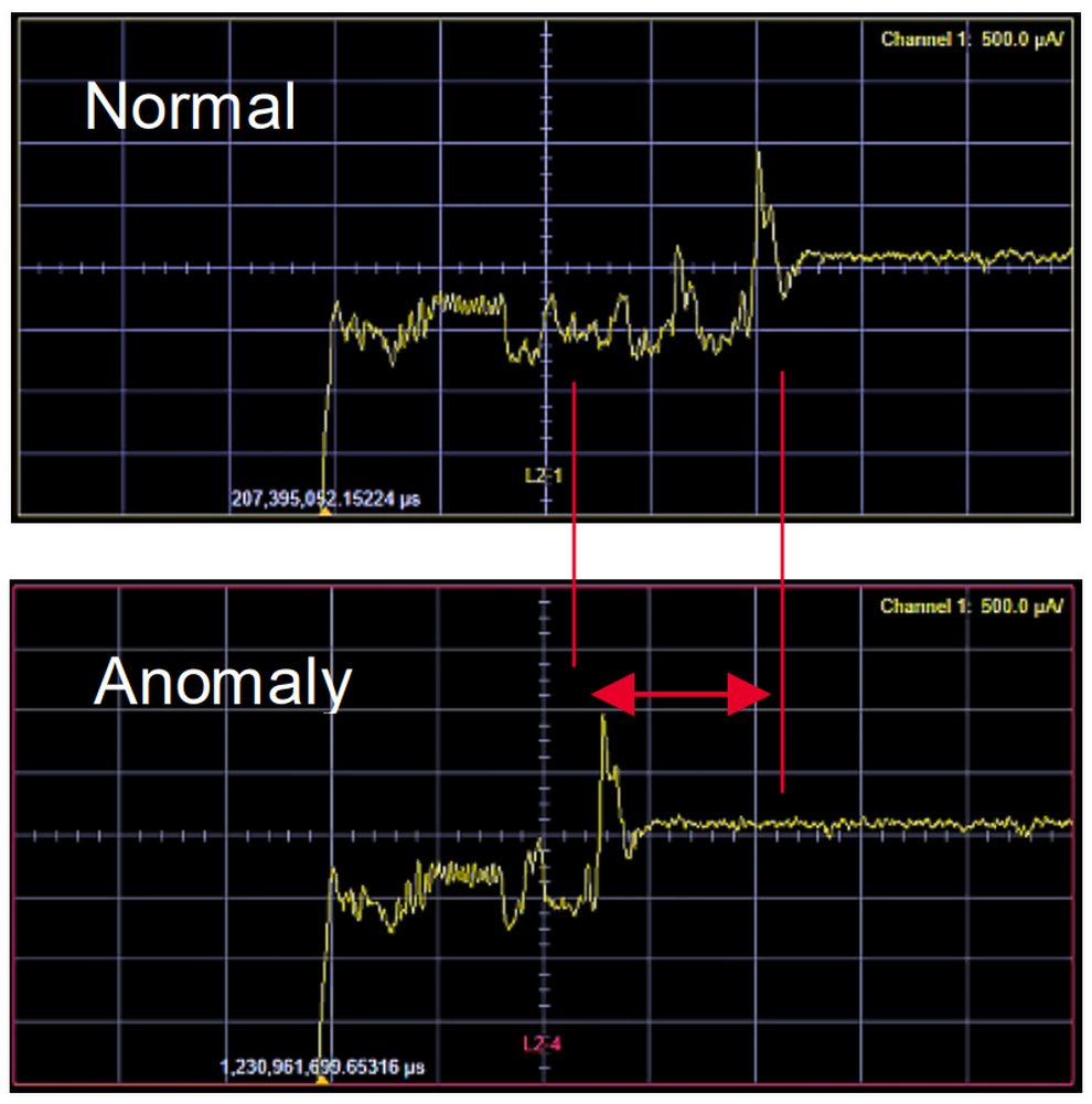Thời lượng pin của các thiết bị y tế cấy ghép - 1