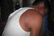 Thêm một người chống tham nhũng bị hành hung