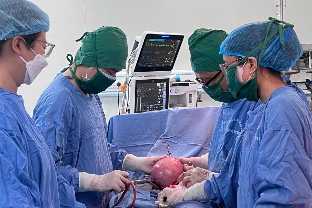 Woman carries 3kg uterine fibroid, equivalent to a fetus - 1 Người phụ nữ mang khối u xơ tử cung nặng 3kg, tương đương một thai nhi - 1