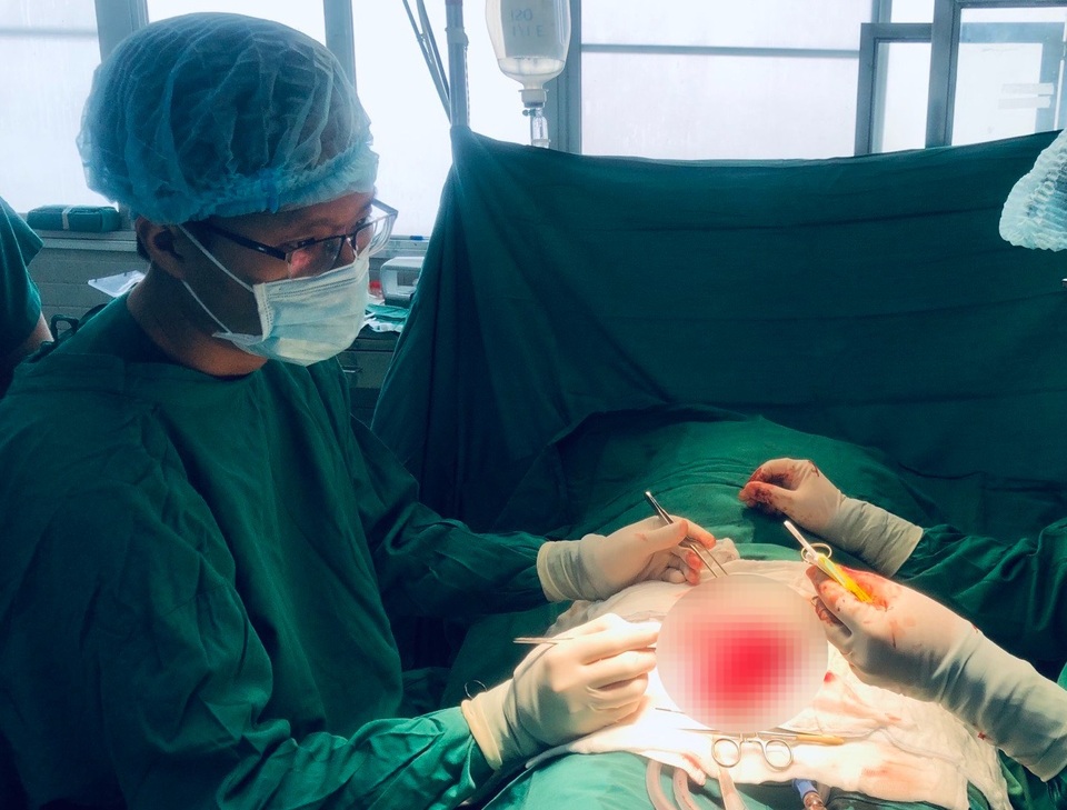 Chồng đang ngủ say bị vợ dùng kéo cắt lìa dương vật - 1 Chồng đang ngủ say bị vợ dùng kéo cắt lìa dương vật - 1