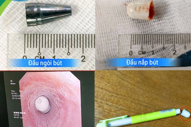 Trẻ có thể tắt thở, chết não vì tai nạn gặp rất phổ biến