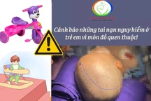 Ngã xe 3 bánh, bé 15 tháng tuổi tụ máu não
