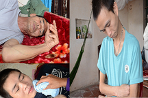 Cuộc sống khốn cùng của 3 cha con người cựu chiến binh cùng mắc bệnh teo não