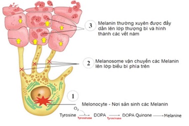 Vì sao 80% phụ nữ thất bại khi điều trị nám sạm da?