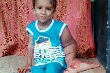 Cậu bé "tay voi" bị cả làng xa lánh