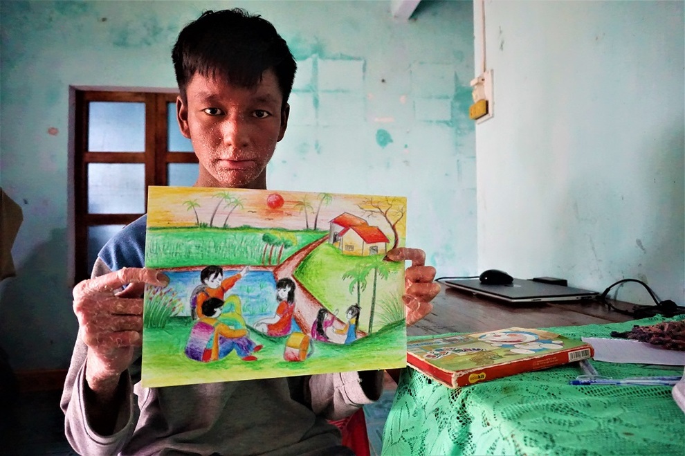 Cuộc sống của cậu bé người rắn từng bị xa lánh bây giờ ra sao? - 8 Cuộc sống của cậu bé người rắn từng bị xa lánh bây giờ ra sao? - 8