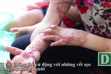 Cuộc đời buồn của hoa khôi 9x xinh đẹp bị chồng tẩm xăng thiêu đốt