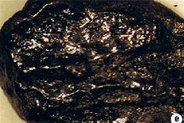 Kim cương đen là “người ngoài hành tinh”