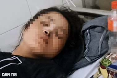 Mẹ 2 con hoại tử, co giật ở bến xe sau khi vào viện sắc đẹp ở TPHCM sửa mũi