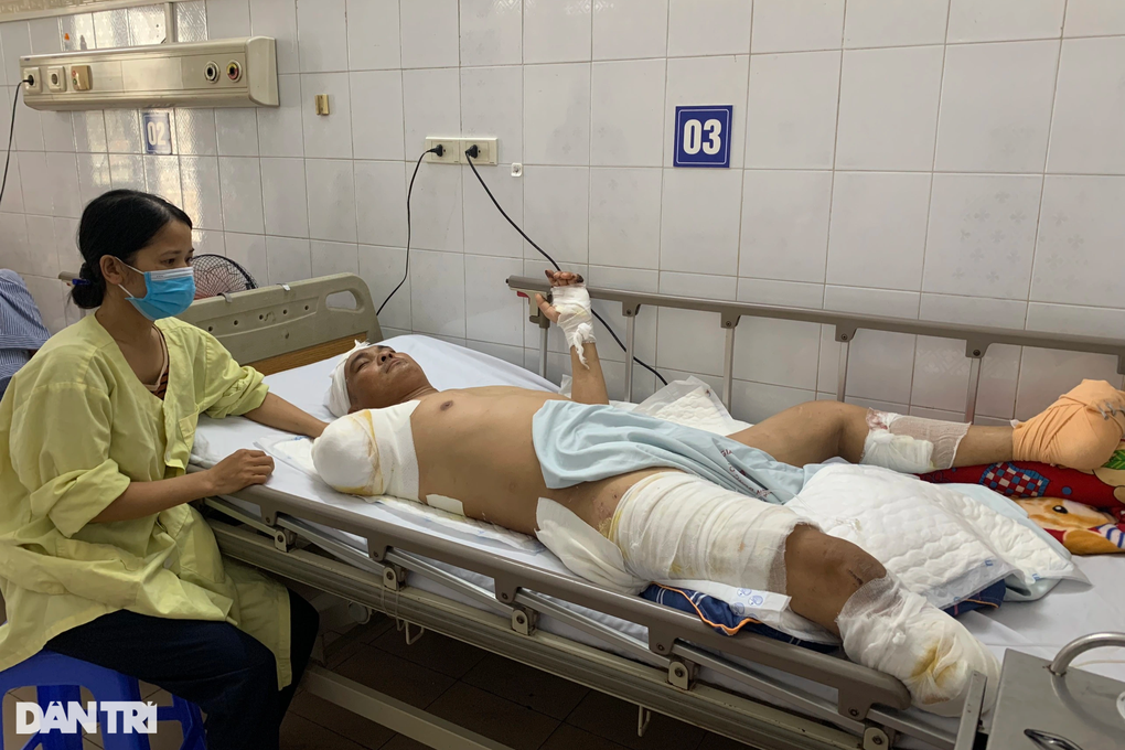 Bỏng điện cao thế, người đàn ông trụ cột gia đình phải cắt cụt tay, chân - 6