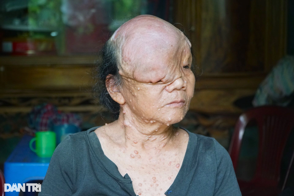 Sóng gió cuộc đời người đàn bà mang khuôn mặt quỷ - 2 Sóng gió cuộc đời người đàn bà mang khuôn mặt quỷ - 2