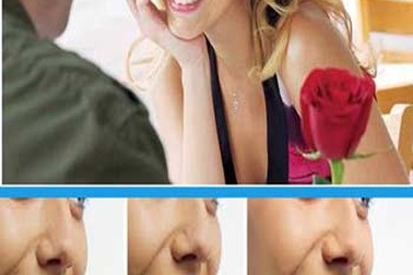 Chỉnh nha Invisalign không cần mắc cài