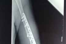 Nhân viên y tế bị tố bẻ gãy tay bệnh nhân