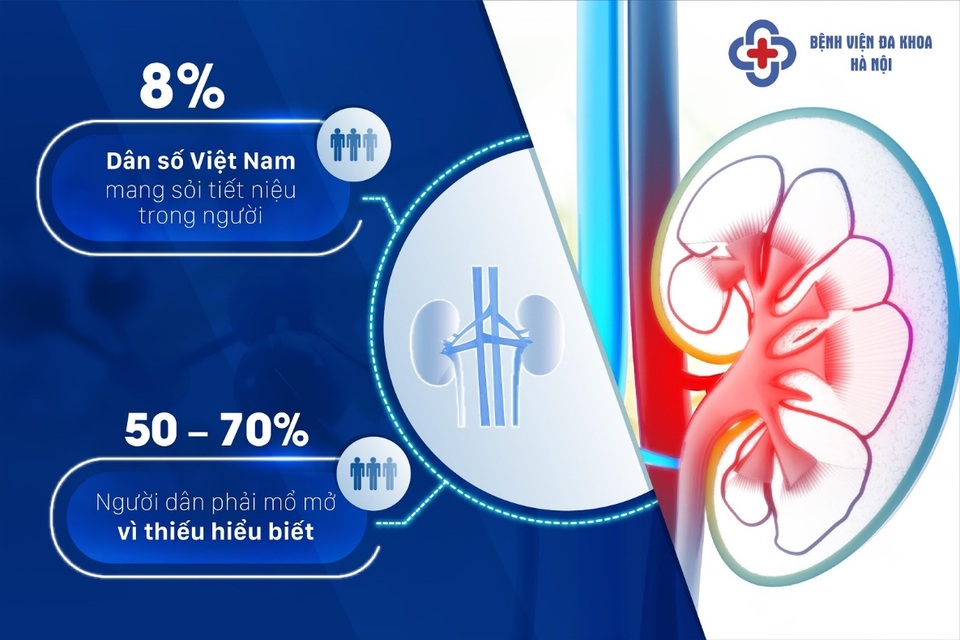 Gần 70% người bệnh phải mổ mở thậm chí bị cắt thận vì thiếu hiểu biết - 1 Gần 70% người bệnh phải mổ mở thậm chí bị cắt thận vì thiếu hiểu biết - 1
