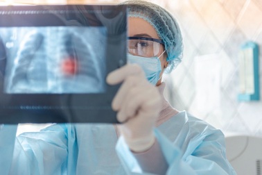 Mắt đỏ có thể là dấu hiệu nhiễm virus corona