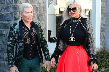 “Búp bê Ken” Rodrigo Alves và bạn gái cùng phẫu thuật cắt bỏ xương sườn
