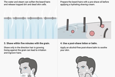 4 bước để không bị rát da khi cạo râu