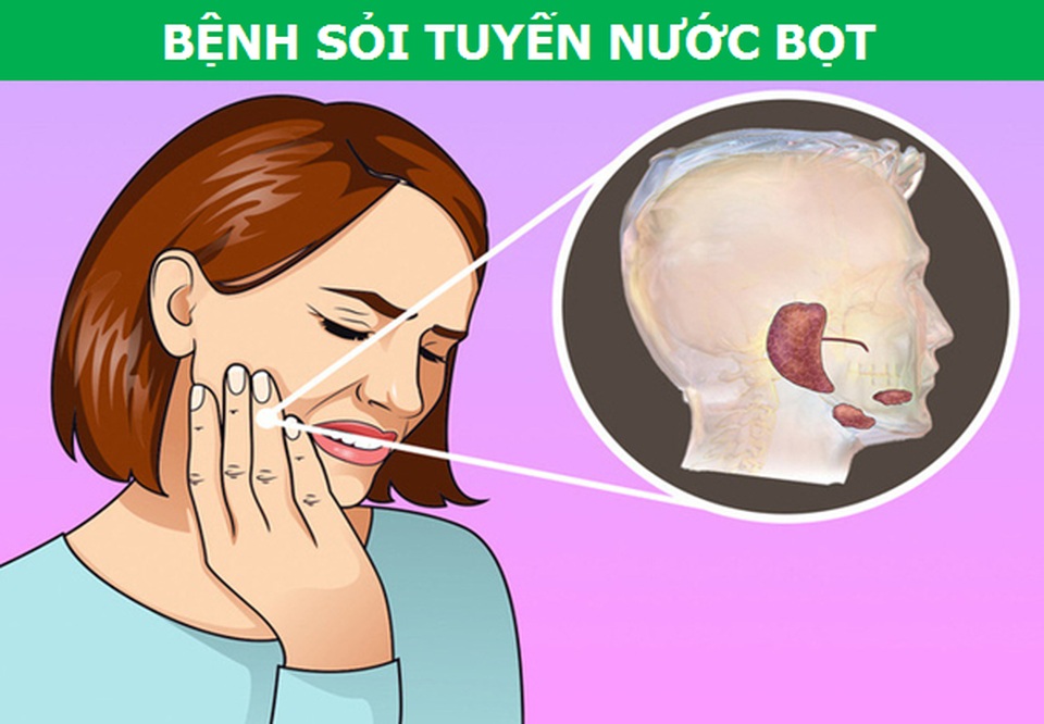 Những cơn đau kỳ lạ xuất phát từ răng miệng nói lên điều gì về sức khỏe? - 3 Những cơn đau kỳ lạ xuất phát từ răng miệng nói lên điều gì về sức khỏe? - 3