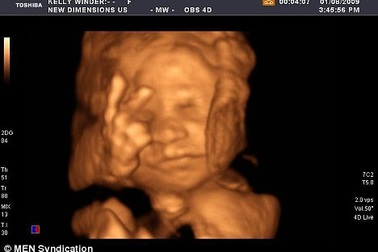 10 câu chuyện kỳ quặc nhất năm 2009