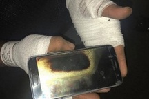 Một người đàn ông bị bỏng khá nặng do Galaxy S7 phát nổ trên tay