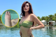 Siêu mẫu Võ Hoàng Yến bị thoái hóa khớp tuổi 35, việc catwalk ra sao?