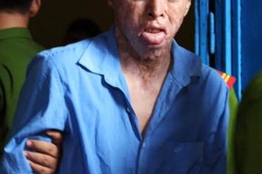 Hình hài của nam thanh niên dùng xăng thiêu sống người yêu