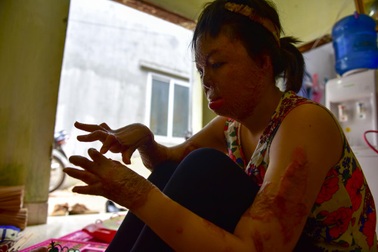 Cuộc đời buồn của cô gái 9x xinh đẹp bị chồng tẩm xăng thiêu đốt