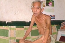 Nỗi khổ của người bệnh không được dùng thuốc