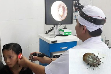 Ve chó chui vào tai, cắn bé gái 10 tuổi đến hoảng loạn