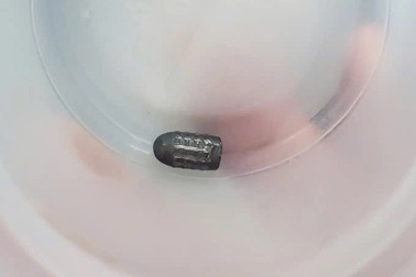 Tìm được thủ phạm dùng súng bắn chim làm người phụ nữ bị trúng đạn