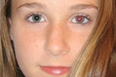 Hướng dẫn khử mắt đỏ trên ảnh một cách nhanh chóng