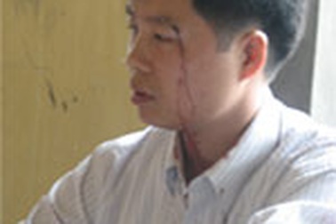 Thanh tra giao thông Hà Tây đánh người?