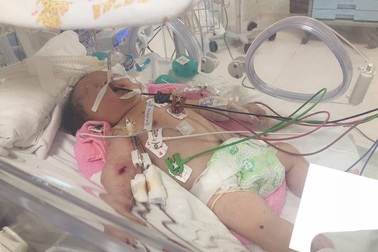 Bé sơ sinh ọc máu, hôn mê vì rối loạn chuyển hóa