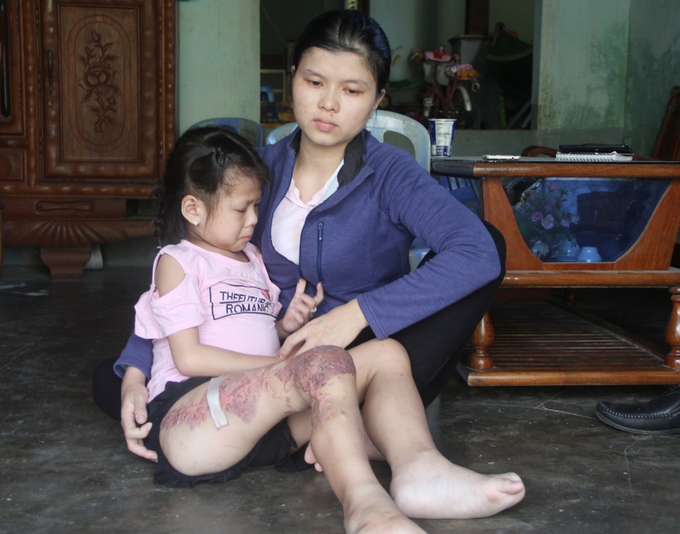 Đau đớn cảnh bé gái trải qua 18 lần phẫu thuật tìm kiếm sự sống mong manh - 1 Đau đớn cảnh bé gái trải qua 18 lần phẫu thuật tìm kiếm sự sống mong manh - 1