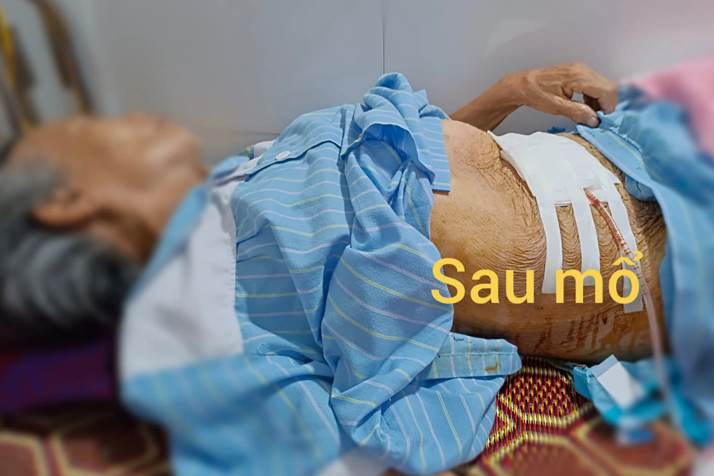 Cụ bà 85 tuổi mang khối u khủng như mang thai 9 tháng - 2 Cụ bà 85 tuổi mang khối u khủng như mang thai 9 tháng - 2