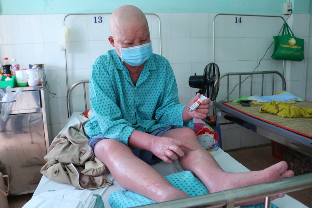 Psoriasis : la douleur physique et mentale de milliers de Vietnamiens - 2 Bệnh vảy nến: Nỗi đau thể xác và tinh thần của hàng nghìn người Việt - 2