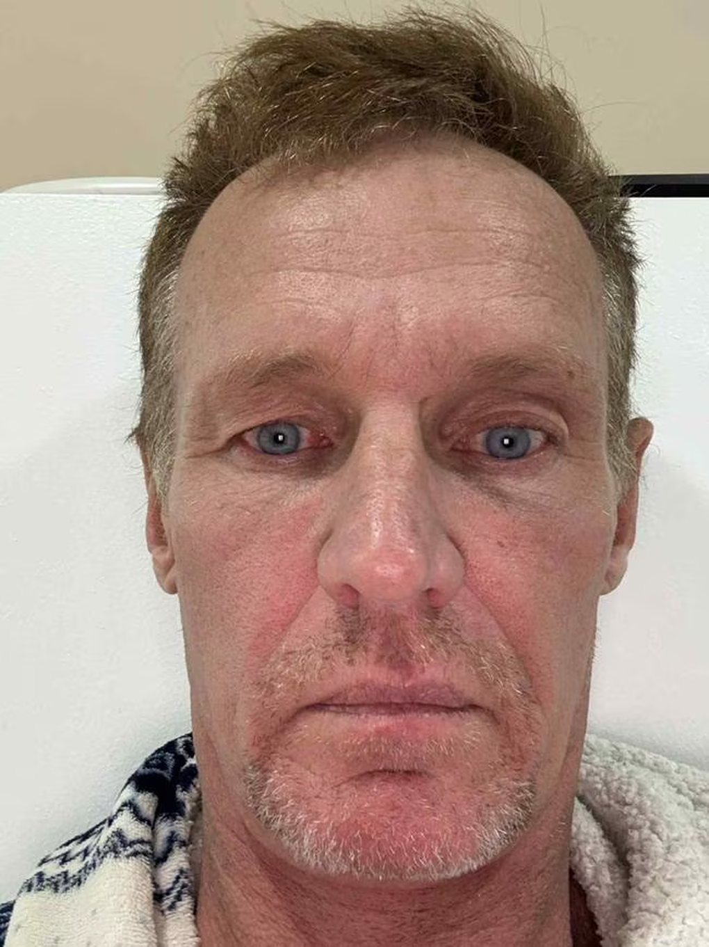 Західні туристи змінюють своє життя після приїзду до В'єтнаму на косметичну операцію - 1 Khách Tây đổi đời sau khi tới Việt Nam phẫu thuật thẩm mỹ - 1