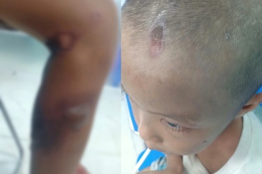 Công an bắt được người cha cùng nhân tình bạo hành bé trai ở TPHCM