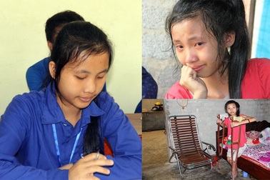 Cảm động chuyện “không gục ngã” của nữ sinh học giỏi mắc chứng bệnh lao khớp háng