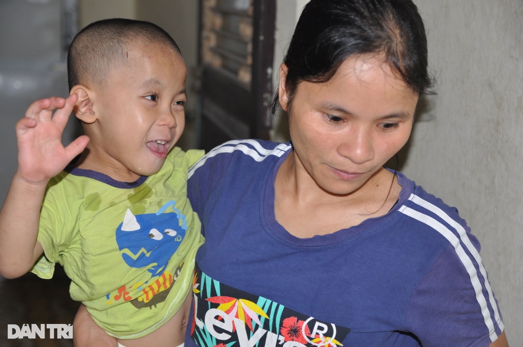 Xót thương người mẹ đơn thân bán hàng rong chăm con bại não - 1 Xót thương người mẹ đơn thân bán hàng rong chăm con bại não - 1