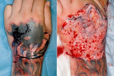 Tự huỷ hoại cơ thể vì xăm mình