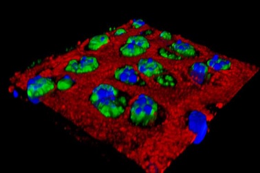 Thuốc tiêm hạt nano có thể là tương lai của điều trị viêm xương khớp