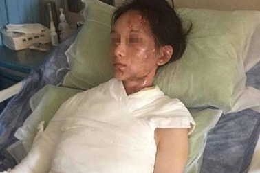 Thực khách bị đổ nước sôi và hành hung vì phàn nàn qua mạng