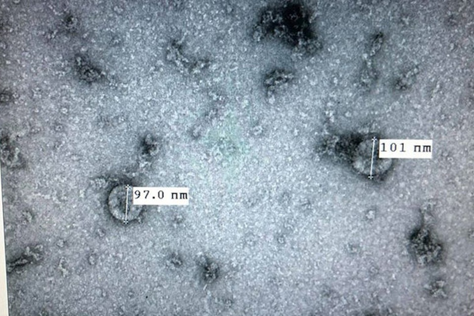 Máy lọc không khí có thể tiêu diệt được virus Covid-19 hay không? - 2 Máy lọc không khí có thể tiêu diệt được virus Covid-19 hay không? - 2