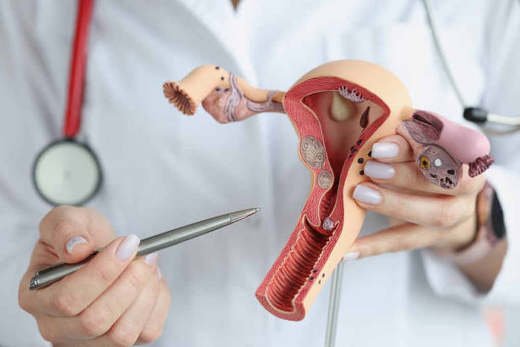 doctor-is-holding-sectional-model-female-reproductive-organs.jpg ung_thu