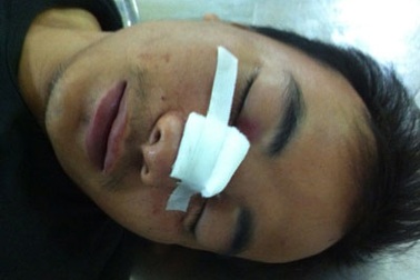 Không cho vượt, tài xế xe khách rút kiếm chém lái xe bồn giữa đường