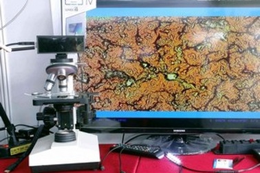 Thiết bị nhúng giúp kết nối kính hiển vi ứng dụng nghe nhìn