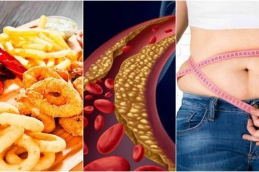 6 yếu tố nguy cơ làm tăng cholesterol máu