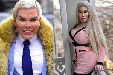 "Búp bê Ken" nổi tiếng một thời gây sốc khi phẫu thuật thành phụ nữ gợi cảm