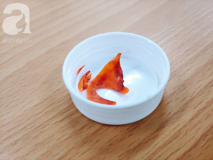 Bé trai 11 tháng tuổi thủng thực quản suýt chết bởi chính món đồ chơi quen thuộc bà mẹ nào cũng dùng để dỗ con - Ảnh 6.